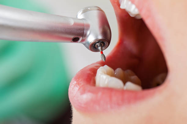 Best Pediatric Emergency Dentist in Oak Grove, MS